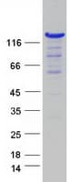 Human WDR44 Protein (Recombinant Myc-DDK (Flag))
