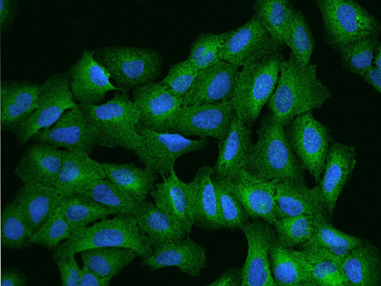 ARHGEF1 Antibody