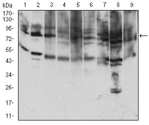 CD71 / Transferrin Receptor Antibody (aa608-727, clone 1A1B2)