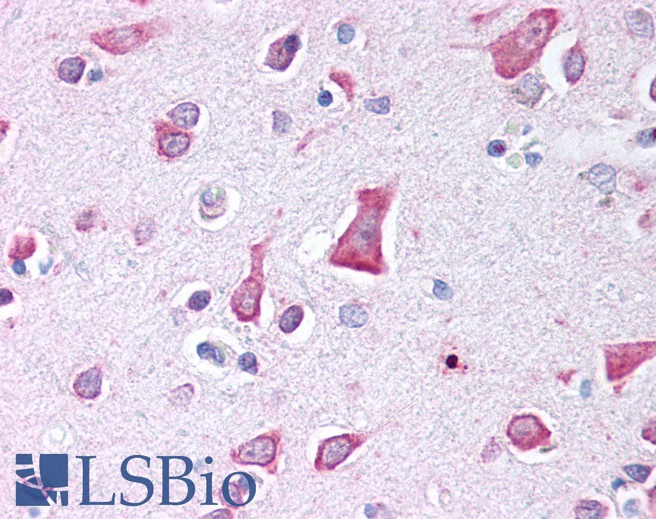IHC-plus™ NOL3 / ARC Antibody (aa125-141)