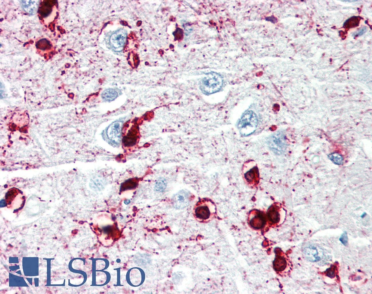 IHC-plus™ CRYAB / Alpha B Crystallin Antibody (clone 1B6.1-3G4)