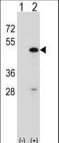 Polyclonal Rabbit anti-Human RBM22 Antibody (aa165-193, IHC, WB)