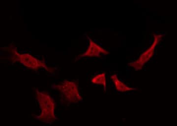 Polyclonal Rabbit anti-Human EGFR Antibody (phospho-Tyr1016, IHC, IF, WB)