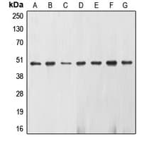 PathPlus™ ENO2 / NSE Antibody (C-Terminus)