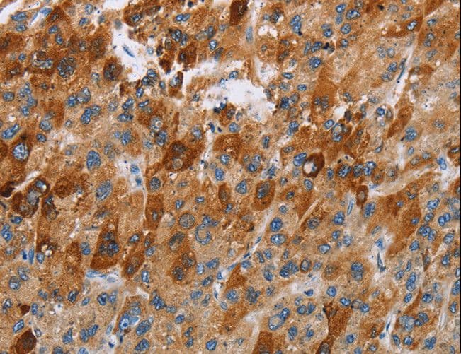 Polyclonal Rabbit anti-Human CCR9 / CD199 Antibody (IHC)