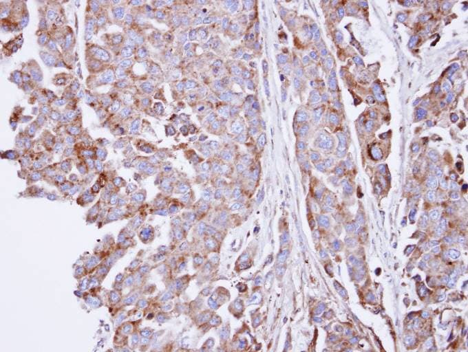 SGSH Antibody (aa318-496)