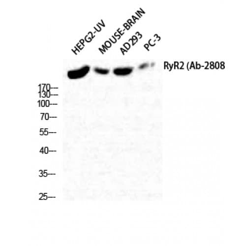 Polyclonal Rabbit anti-Human RYR2 / Ryanodine Receptor 2 Antibody (2750-2830 aa, IHC, IF, WB)