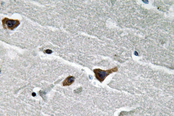 SERPINE1 / PAI-1 Antibody (aa266-315)