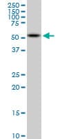 AKT2 Antibody (clone X1)