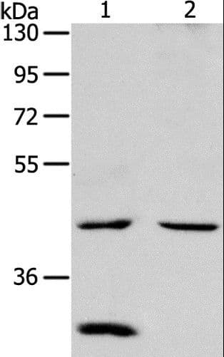 Polyclonal Rabbit anti-Human NCEH1 / AADACL1 Antibody (IHC, WB)