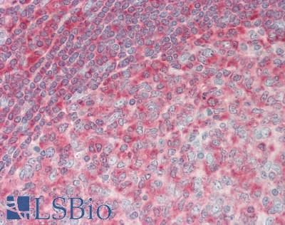 IHC-plus™ TRIP / LRRFIP1 Antibody