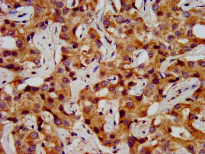 ONECUT1 / HNF6 Antibody