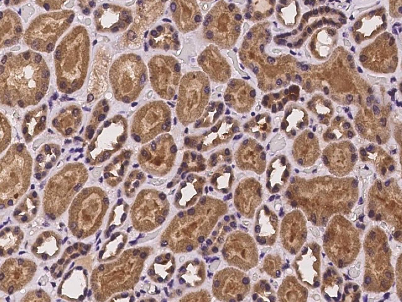PHLDB2 Antibody