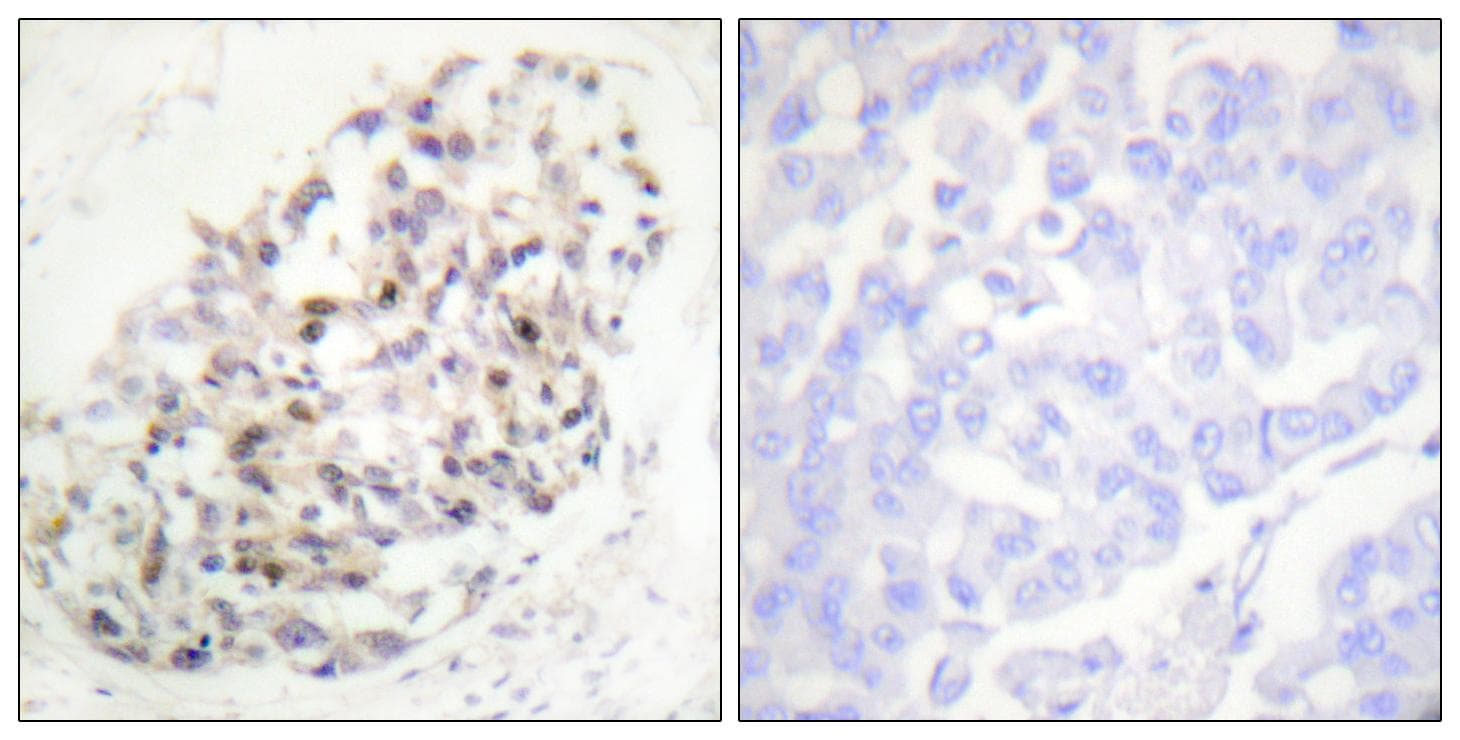 RAB6KIFL / KIF20A Antibody (p528)