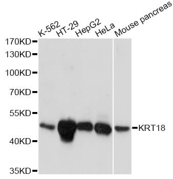 KRT18 / CK18 / Cytokeratin 18 Antibody