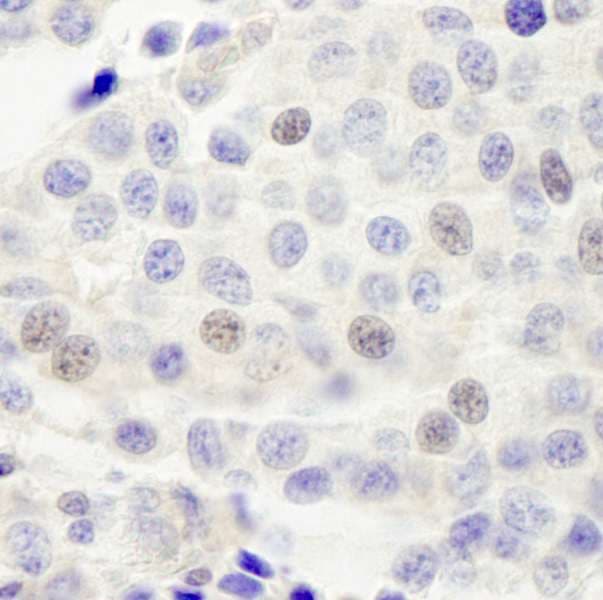 INTS4 Antibody (aa913-963)