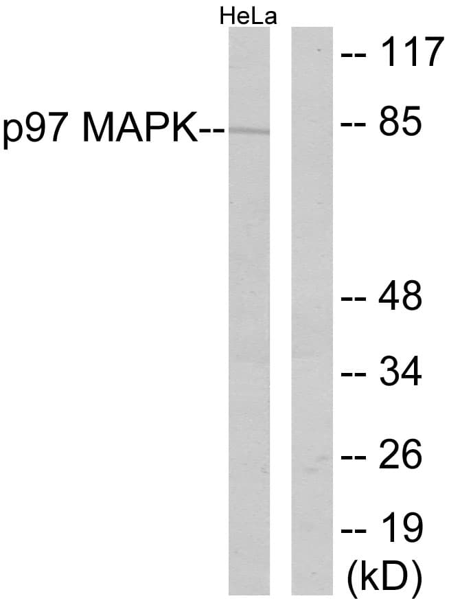 MAPK6 / ERK3 Antibody (aa155-204)
