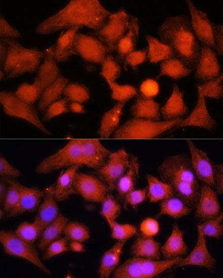 PPARGC1A / PGC-1 Alpha Antibody