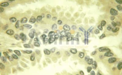 BCL2L1 / BCL-XL Antibody