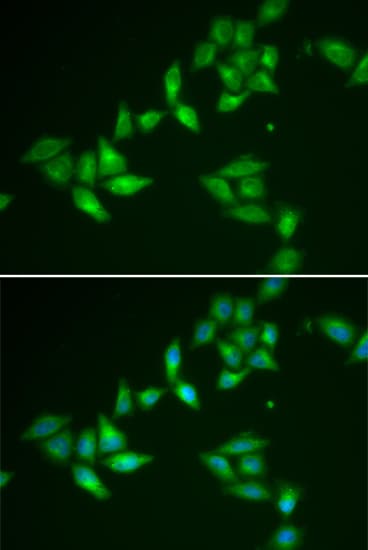TRP32 / TXNL1 Antibody