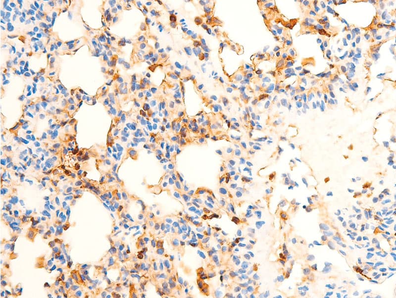 Polyclonal Rabbit anti-Human SYK Antibody (phospho-Tyr323, IHC, IF, WB)