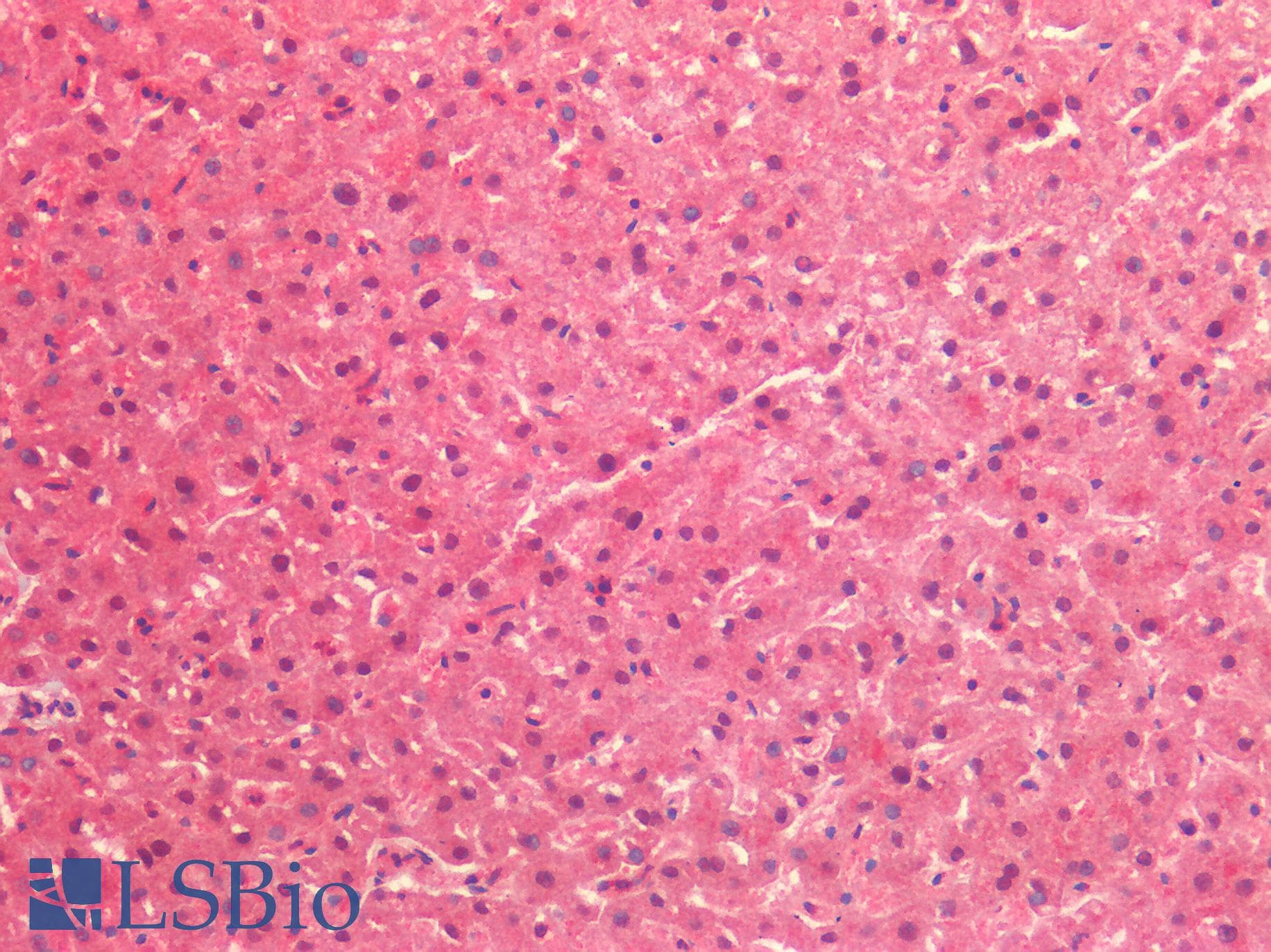 IHC-plus™ Polyclonal Rabbit anti-Human TNC / Tenascin C Antibody (IHC)