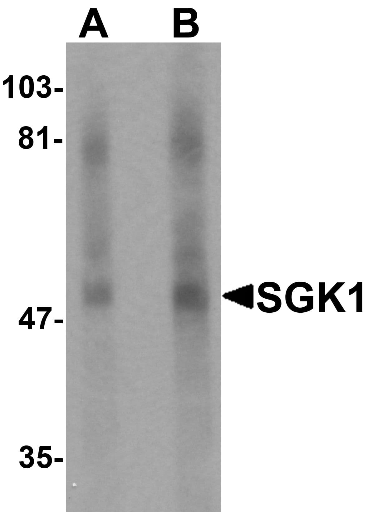 SGK1 / SGK Antibody