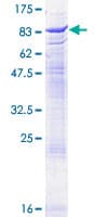 Human ACHE / Acetylcholinesterase Protein (Recombinant GST)
