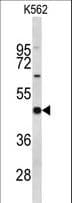 EIF4A2 Antibody (aa333-360)