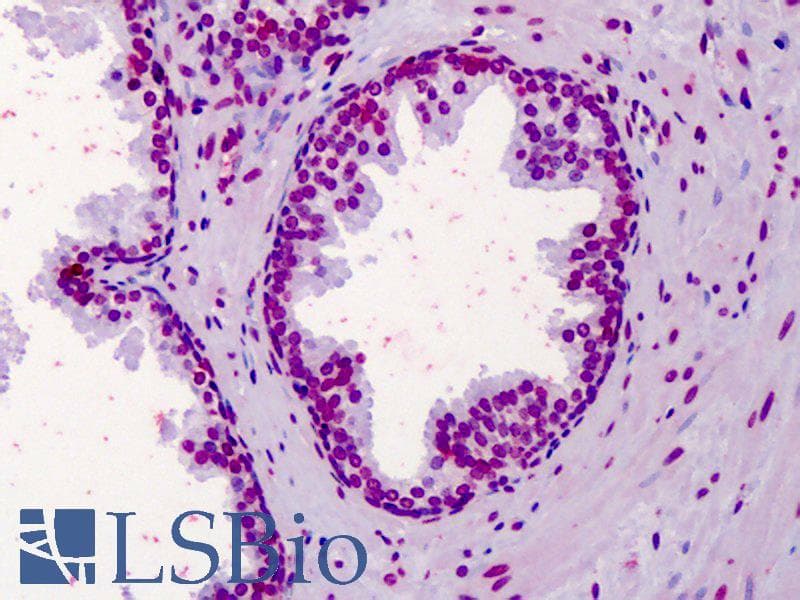 IHC-plus™ Polyclonal Rabbit anti-Human AHR Antibody (aa2-51, IHC, IF, WB)
