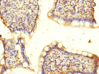 ACCN5 / HINAC Antibody