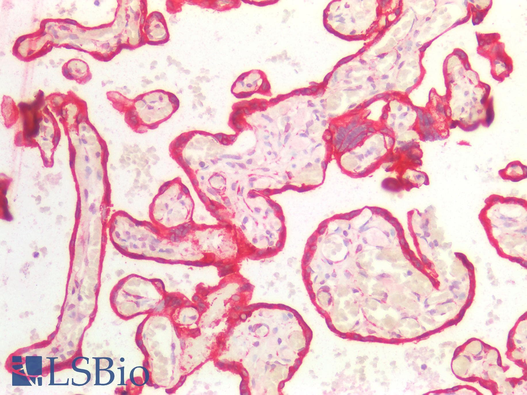 IHC-plus™ Monoclonal Mouse anti-Human KRT18 / CK18 / Cytokeratin 18 Antibody (IHC, WB)