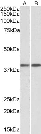 IHC-plus™ Polyclonal Goat anti-Human GNAQ Antibody (aa162-175, IHC, WB)