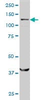 SMC6 Antibody (clone 2E6)