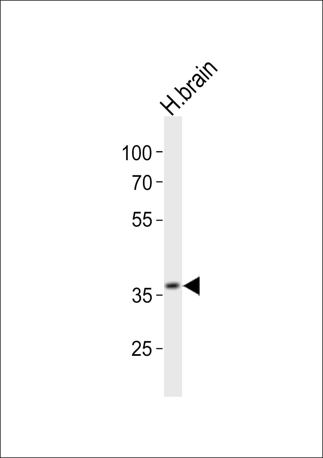 IHC-plus™ UTF1 Antibody (aa164-199)