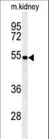 PMPCB / MPP11 Antibody (aa18-46)