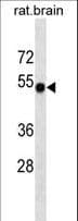 CAMK2A / CaMKII Alpha Antibody