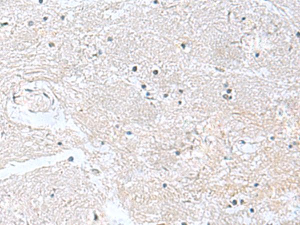 CACNB1 Antibody