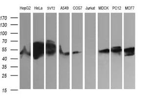 ZSCAN21 / Zipro1 Antibody (clone OTI2E3, Carrier-free)