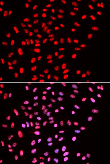 SMARCE1 / BAF57 Antibody