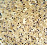 FYTTD1 Antibody (aa26-54)