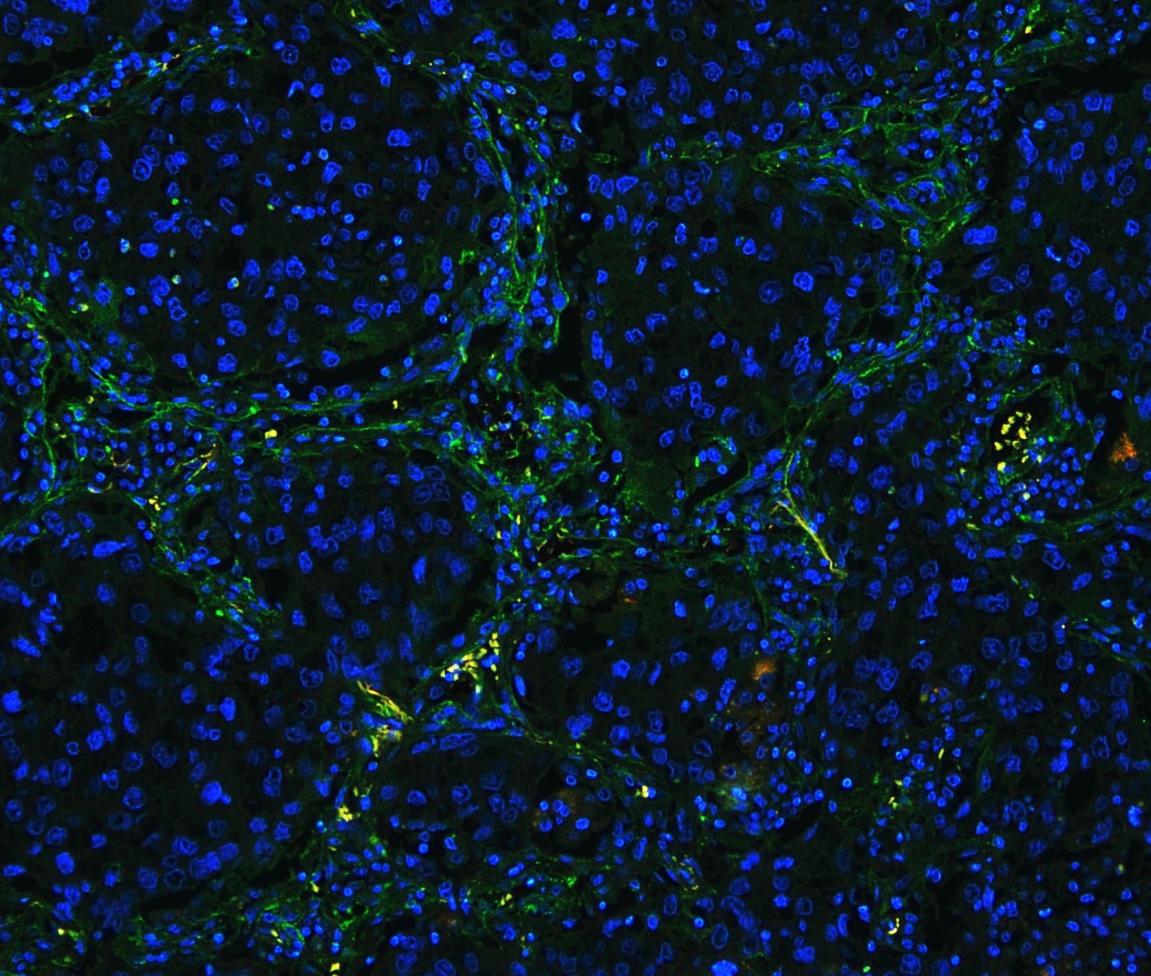 COL4A1 / Collagen IV Alpha1 Antibody (aa1445-1669)