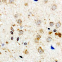 ACO1 / Aconitase Antibody (C-Terminus)