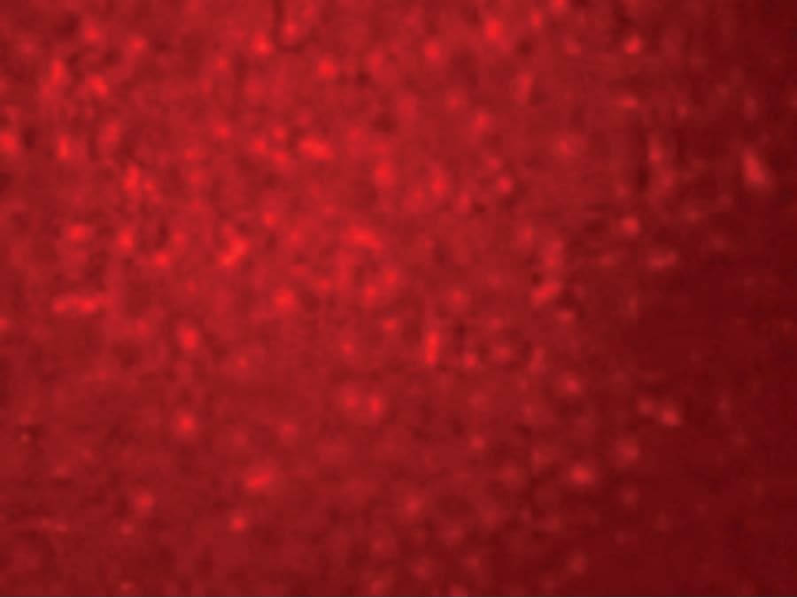 SIVA1 / SIVA Antibody