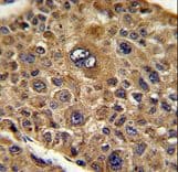 TOB1 / TOB Antibody (aa54-83)