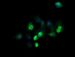 ZSCAN21 / Zipro1 Antibody (clone OTI2E5)