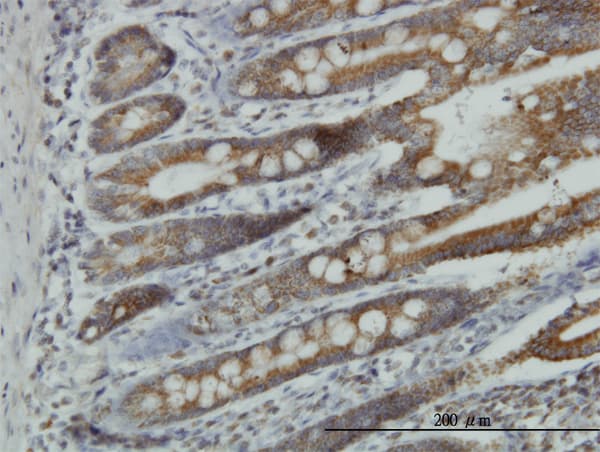 NDUFA9 Antibody (clone 3D7)