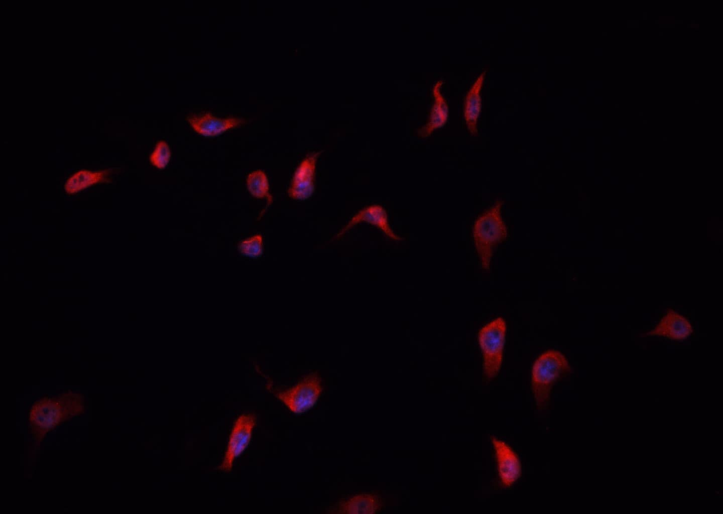 ANXA6/Annexin A6/Annexin VI Antibody