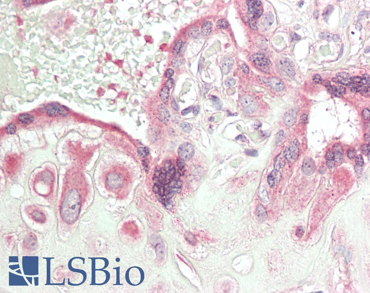 IHC-plus™ Polyclonal Rabbit anti-Human CTHRC1 Antibody (C-Terminus, IHC, WB)