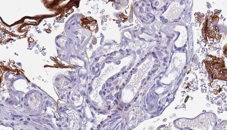 Polyclonal Rabbit anti-Human CD40L Antibody (IHC, WB)
